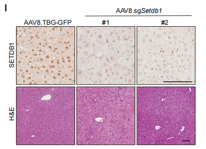 【维真生物AAV、腺病毒感染小鼠肝脏】Cas9-KI小鼠感染AAV8-TBG-GFP/AAV8-TBG-sgSetdb1的代表性H&E和IHC图像