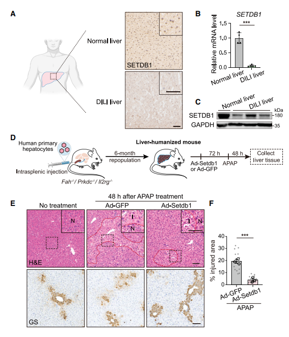 【维真生物AAV、腺病毒感染小鼠肝脏】图3. SETDB1过表达可减轻APAP诱导的肝人源化小鼠肝损伤