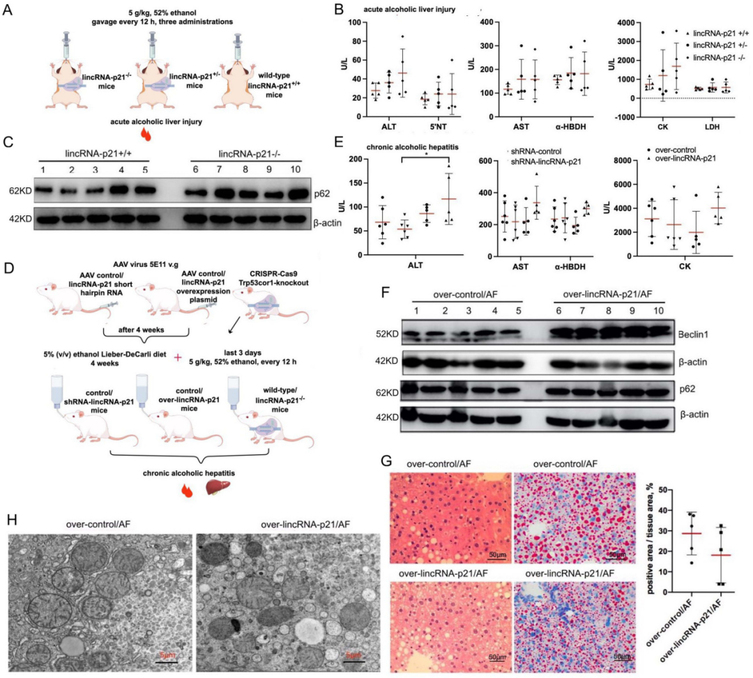 AAV8感染小鼠实验: 图1 lincRNA-p21在急慢性ALD中的作用