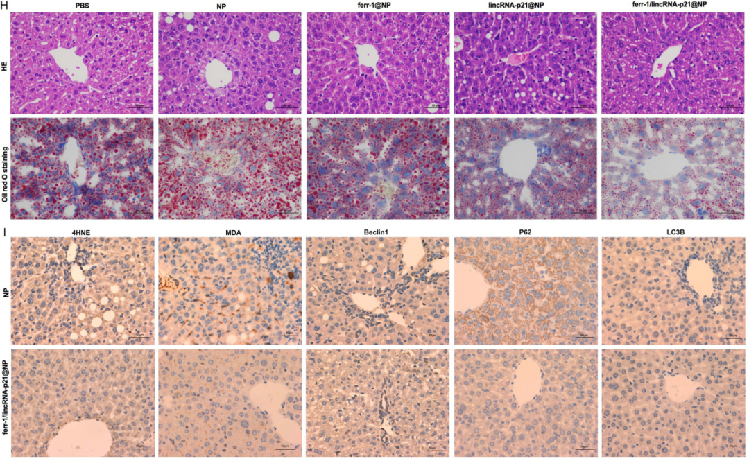 AAV8感染小鼠实验:图2 ferr-1/lincRNA-p21@NPs对酒精性肝损伤的影响