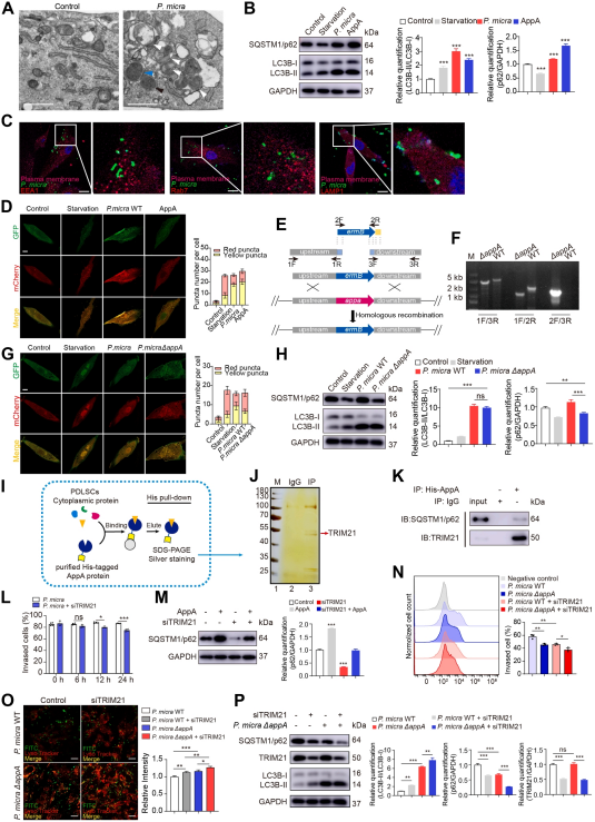 <em>P. micra</em>通过AppA-TRIM21相互作用损害PDLSC自噬以增强细胞内存活
