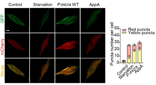 P.micra感染的PDLSC中mCherry-GFP-LC3融合蛋白的代表性荧光图像