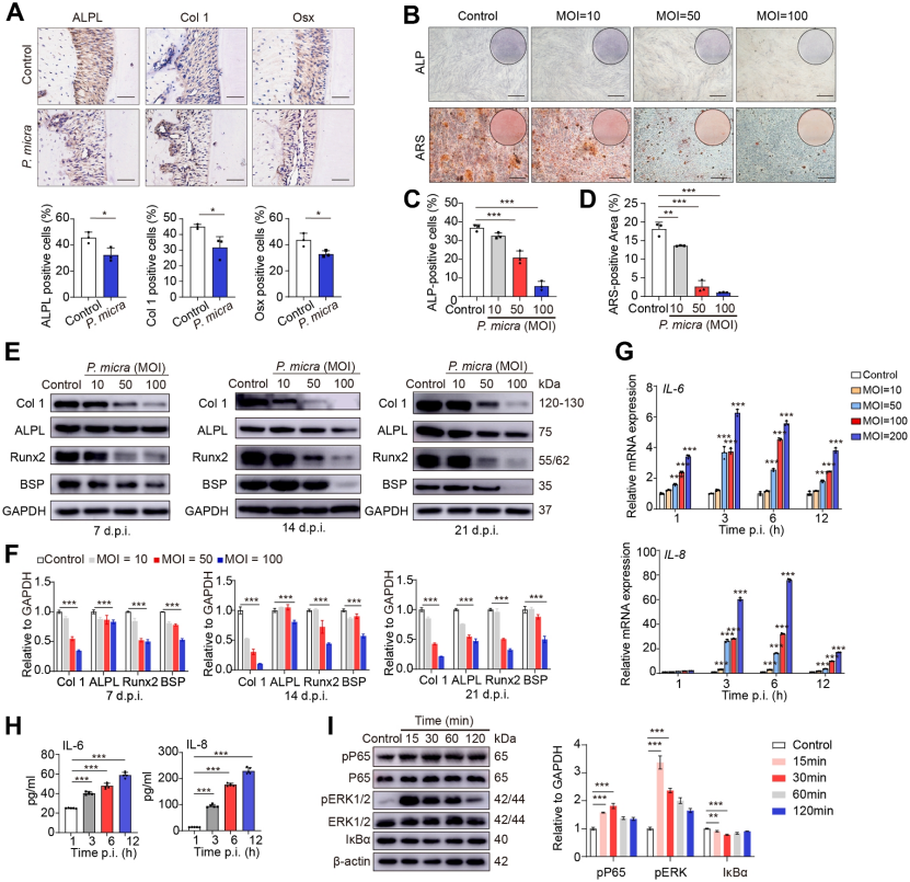 P.micra诱导炎症并损害PDLSC的成骨能力