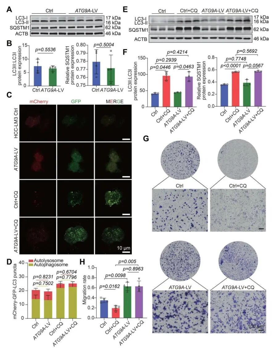 AAV8感染小鼠_图3. ATG9A的非自噬功能促进细胞迁移结论