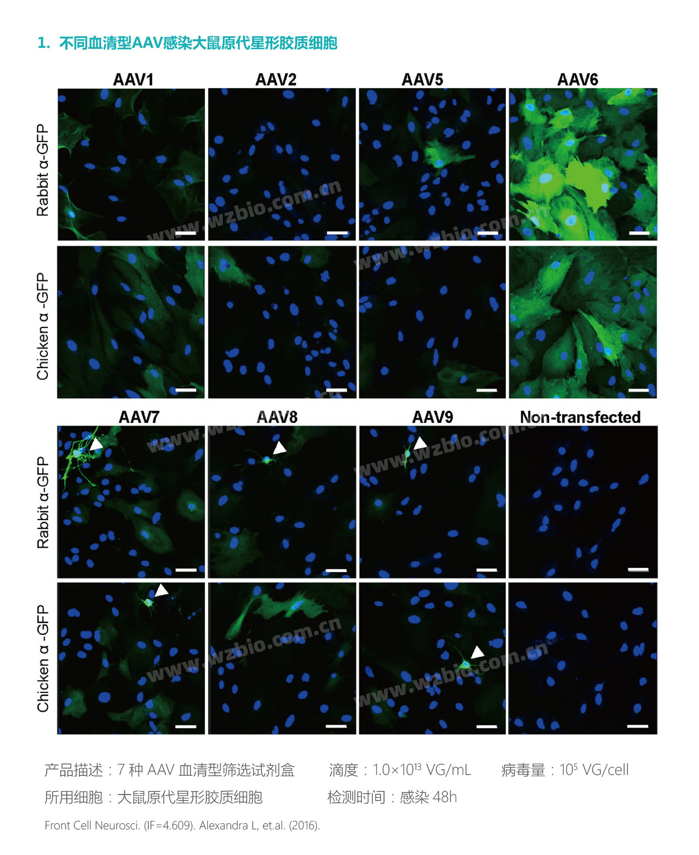 不同血清型AAV感染大鼠原代星形胶质细胞