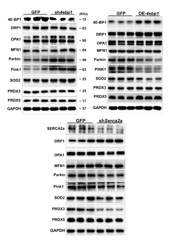 WB结果证实AAV9介导4ebp1敲低和过表达以及Serca2a敲低结果