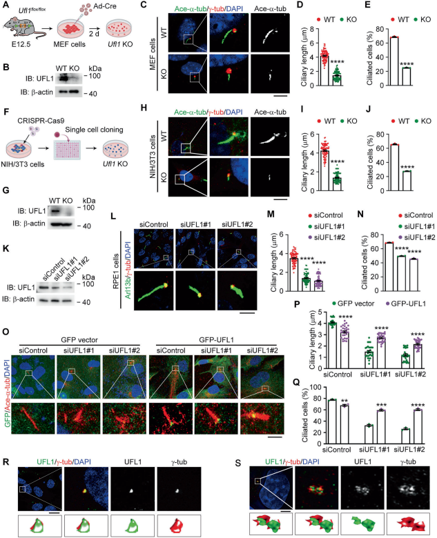 UFL1定位于基体并促进纤毛形成