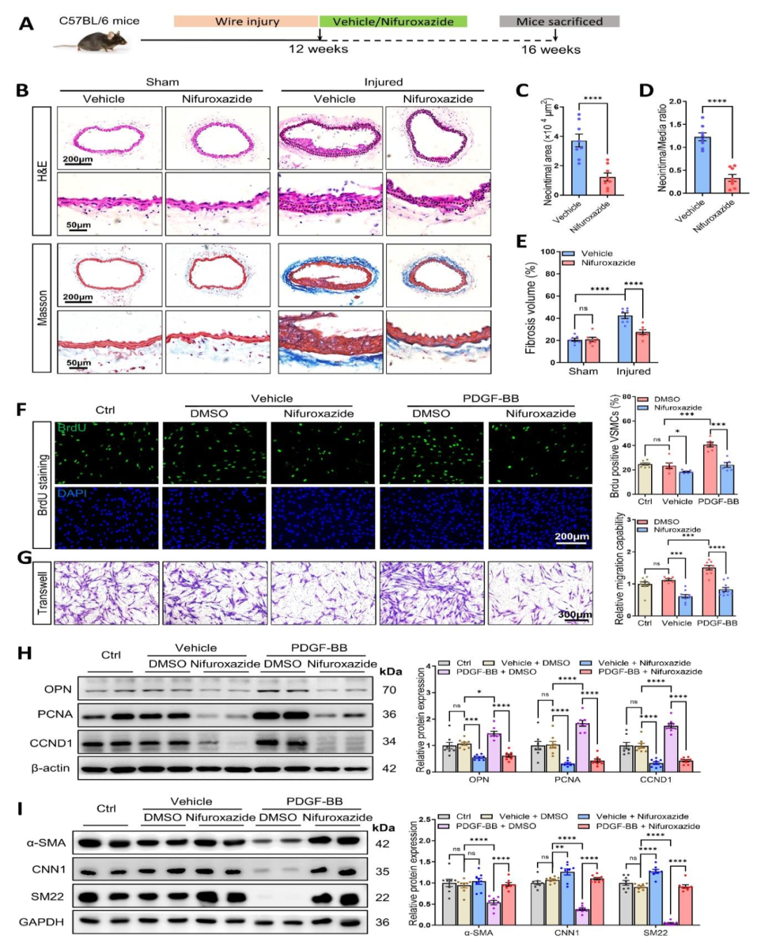 Nifuroxazide减少小鼠血管重塑并抑制VSMC表型转换