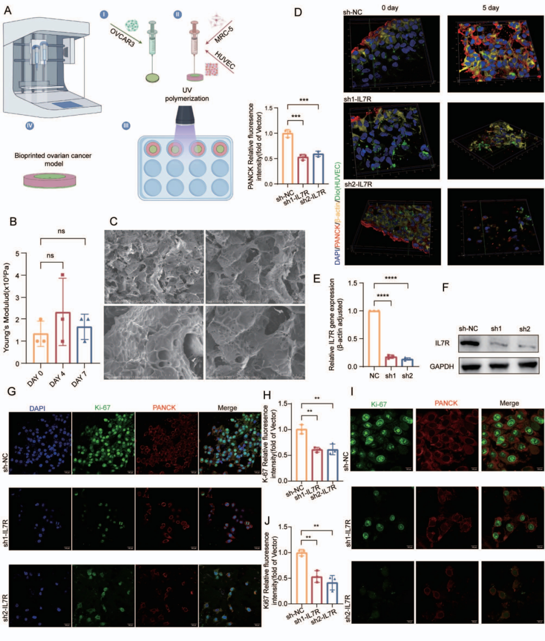 图1 3D生物打印肿瘤-基质共培养模型和IL7R功能分析