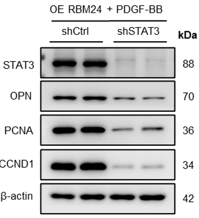 WB实验表明Lv-shSTAT3成功敲低基因表达