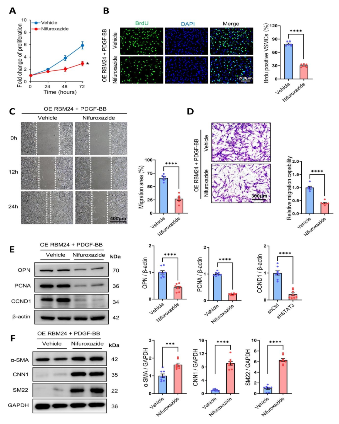 STAT3抑制剂阻断RBM24过表达对体外VSMC表型转换的影响