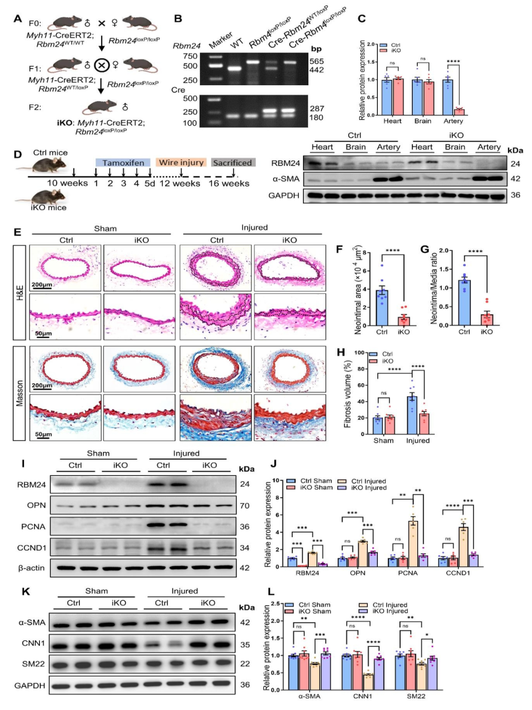 SMC特异性敲除Rbm24可减少体内血管重塑
