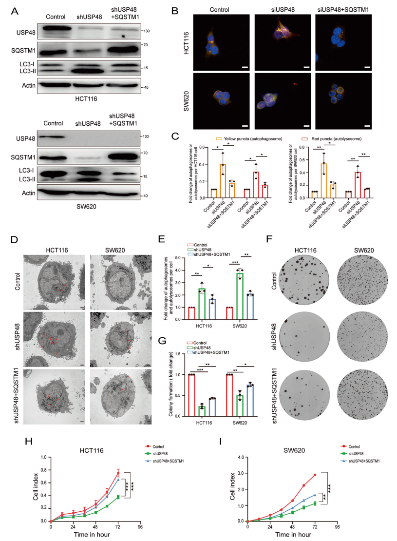 USP48通过稳定SQSTM1抑制自噬并促进结直肠癌进展