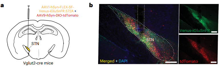 AAV神经递质探针在STN成功表达