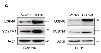 WB结果显示腺病毒成功介导USP48的过表达和敲低