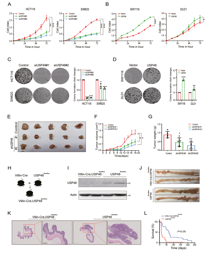USP48促进结直肠癌的体内外进展