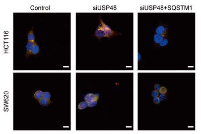 利用Ad-mCherry-GFP-LC3评估自噬通量结果图