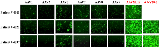 AAV843 壳蛋白在人类原代肝细胞中的感染效率最高