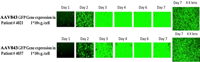 绿色荧光蛋白基因在人原代肝细胞中表达水平高且持久