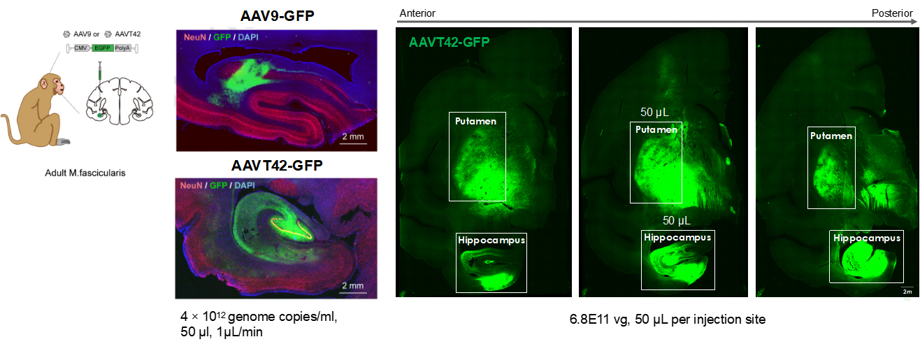 AAVT42对食蟹猴神经组织的感染效率