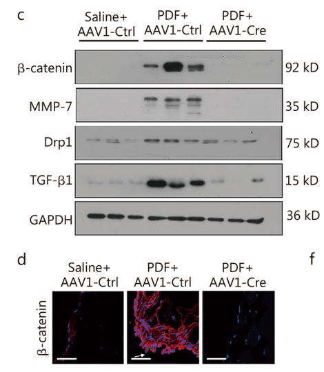 蛋白印迹和免疫荧光证实AAV1-Cre成功敲除β-连环蛋白图