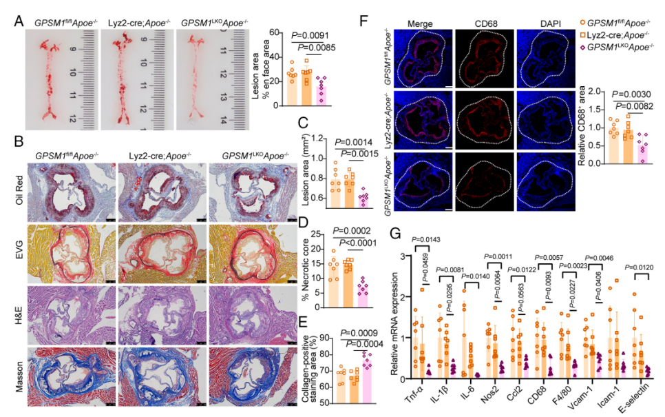 髓系GPSM1缺失保护小鼠免受动脉粥样硬化