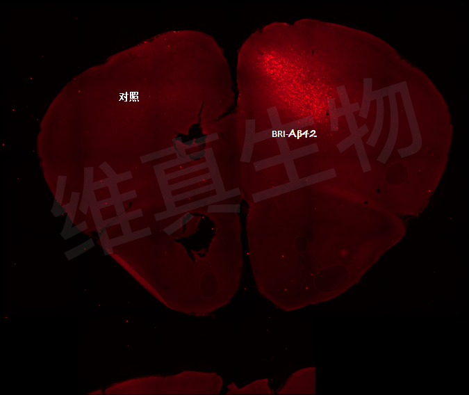 运动皮层BRI-Aβ42表达荧光图