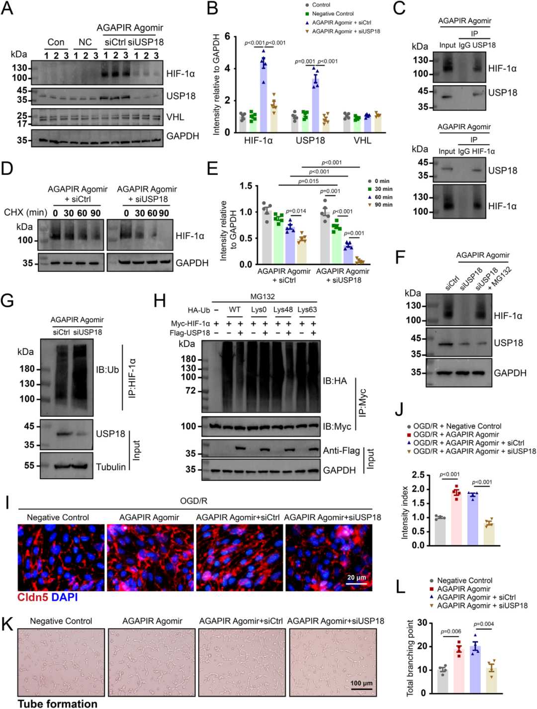 AGAPIR通过调节USP18/HIF-1α轴促进血管生成