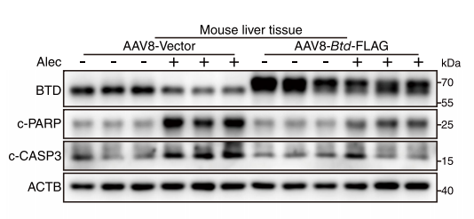 【AAV靶向肝脏_自噬双标腺病毒感染肝细胞案例】Western blot实验证实，小鼠肝脏中 BTD 蛋白实现有效上调