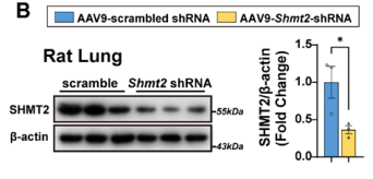 【AAV_腺病毒_质粒_在肺部应用的案例】AAV9-Shmt2-shRNA处理的大鼠肺组织中SHMT2蛋白表达显著降低
