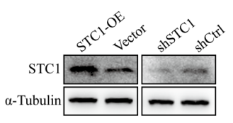 【慢病毒转染肺癌细胞案例】Western blot分析证实了STC1的过表达及沉默